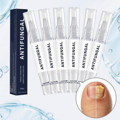 Nail Renewal Pen — Revive nails from dullness and damage. One swipe restores shine with effortless nourishment.